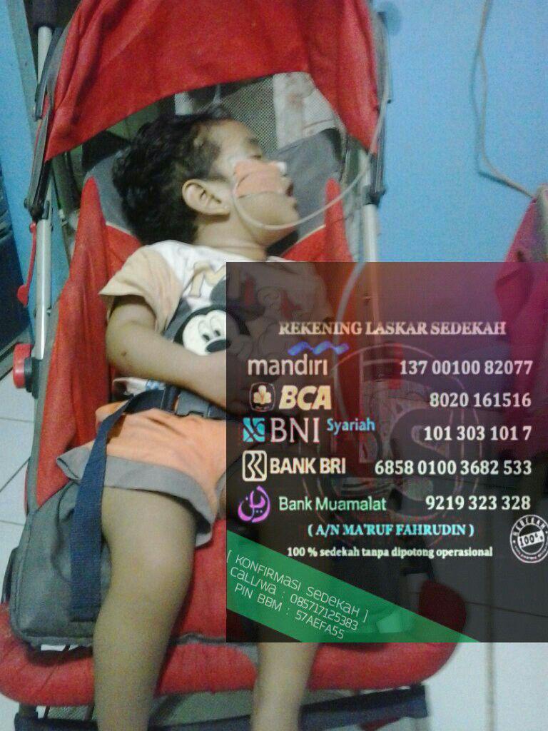 adik ignasia balita 2,2tahun mengalami infeksi otak &amp; epilepsi, adiknya Michael 8bln mnderita gizi buruk. Yuk bantu!