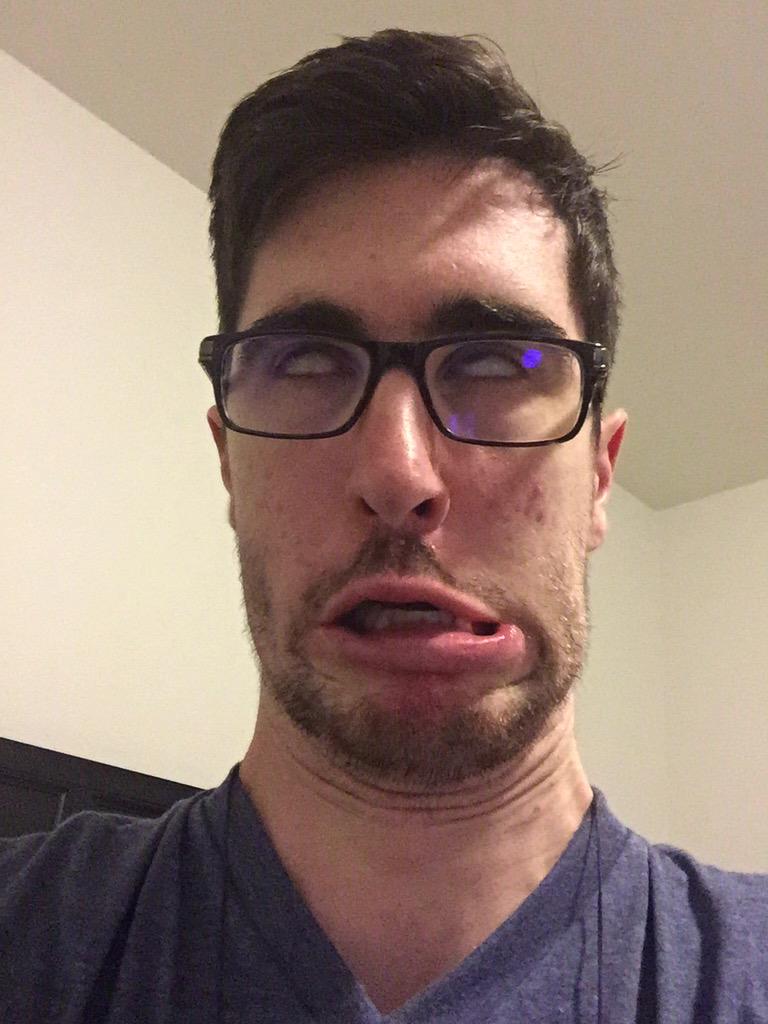 Nogla. 