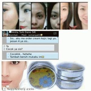 BeaautyShop's tweet photo. READY CREAM WAJAH KOJIC 1PAKET SIANG+MALAM 90RB ADA BPOM NO MERCURY...TINGGAL 1 PAKET YAA http://t.co/E1e14y8RMn