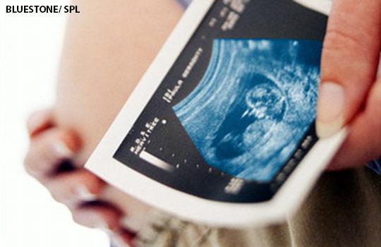 bmj_latest's tweet photo. Research on risk of recurrent stillbirth http://t.co/uCnRN1pE7H &amp; how drs can help families http://t.co/zSvP5LDCoj http://t.co/0on3TJNCls