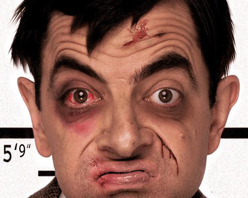 BeanzPark's tweet photo. We hope that your eye is better today @BPlayer1981. #PRAYFORBP #BEANZZZZZ http://t.co/L22uBpF8AE