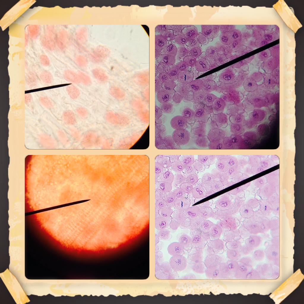 MrsVeraasClass's tweet photo. Mitosis:plants vs animals. We need your undivided attention! #CASEASA2015 #caseraiders @case4learning @kmclaflin http://t.co/DRAp5S3uWq