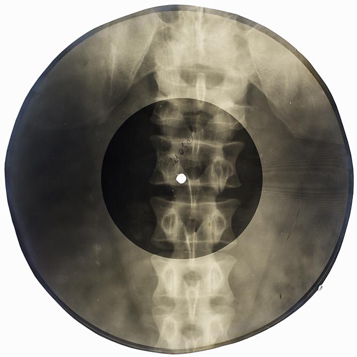ClashMagazine's tweet photo. How Soviet bootleggers used x-ray technology to defy Communist officials... http://t.co/6ZJJ1M0E4J http://t.co/v4Wc4Jt60x