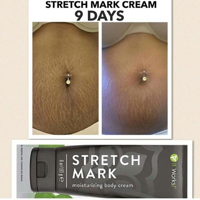 wraplady365's tweet photo. Stretch mark cream!!! A must have http://t.co/gp6DndCf1L