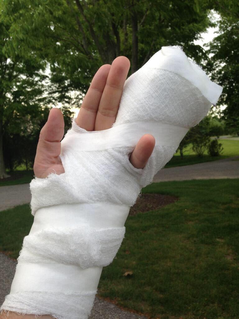 swiftlyruzek's tweet image. 1974-2015 RIP to Jimmy's accident prone left hand @jimmyfallon