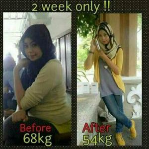 devishopss's tweet photo. Yuhuuu..serum pelangsing yg hitz bgt loh,sekali oles lgsng ilang.. only 350rb..order? line : fladevi/sms: 0817452686 http://t.co/tuyijHjlD4