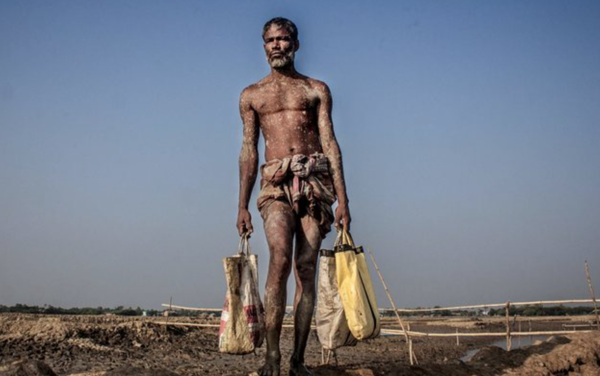 democrio's tweet photo. A definite eye opener 'Environmental Photographer of the Year' http://t.co/IhkR6DDXug http://t.co/sG1g9Qo89D http://t.co/7Lx8cTcUVd