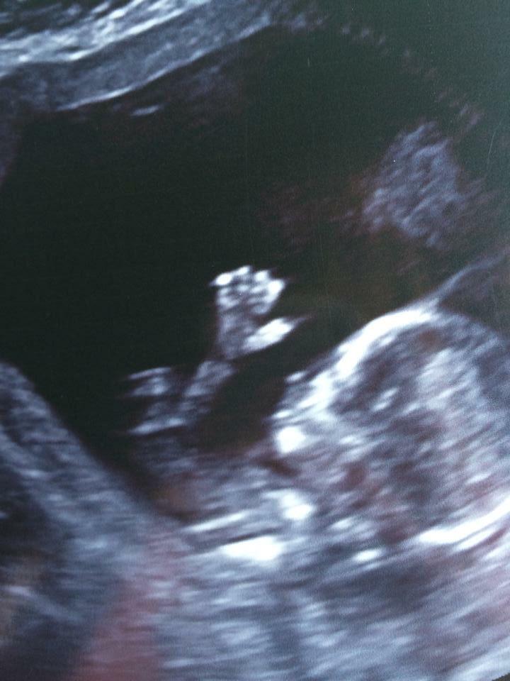 What do you think Kylie's new sibling is going to be?..... Find out tomorrow! #prayersforkylie