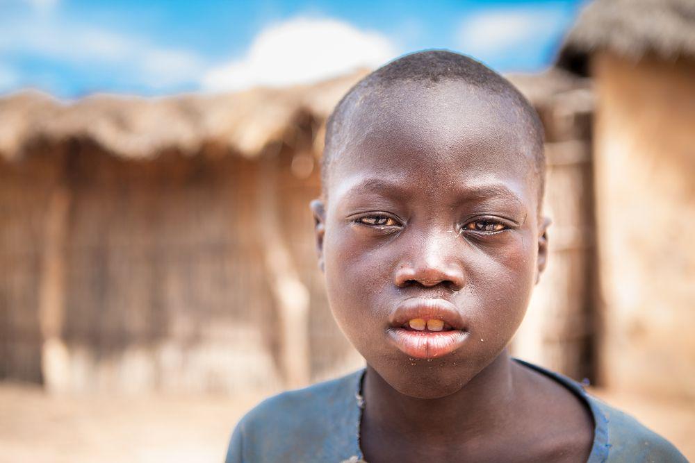 Help a child like Fodé; help eliminate trachoma in Kenya by 2018 sightsavers.org/help-child-lik…