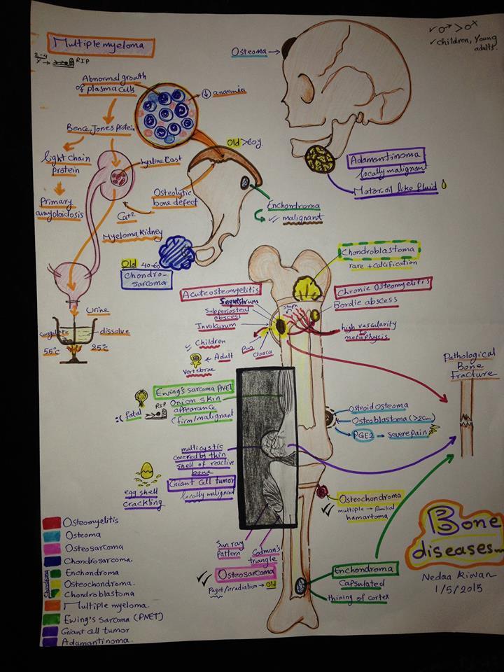My hand drawn diagram for bone diseases meducation.net/resources/1164… #meded