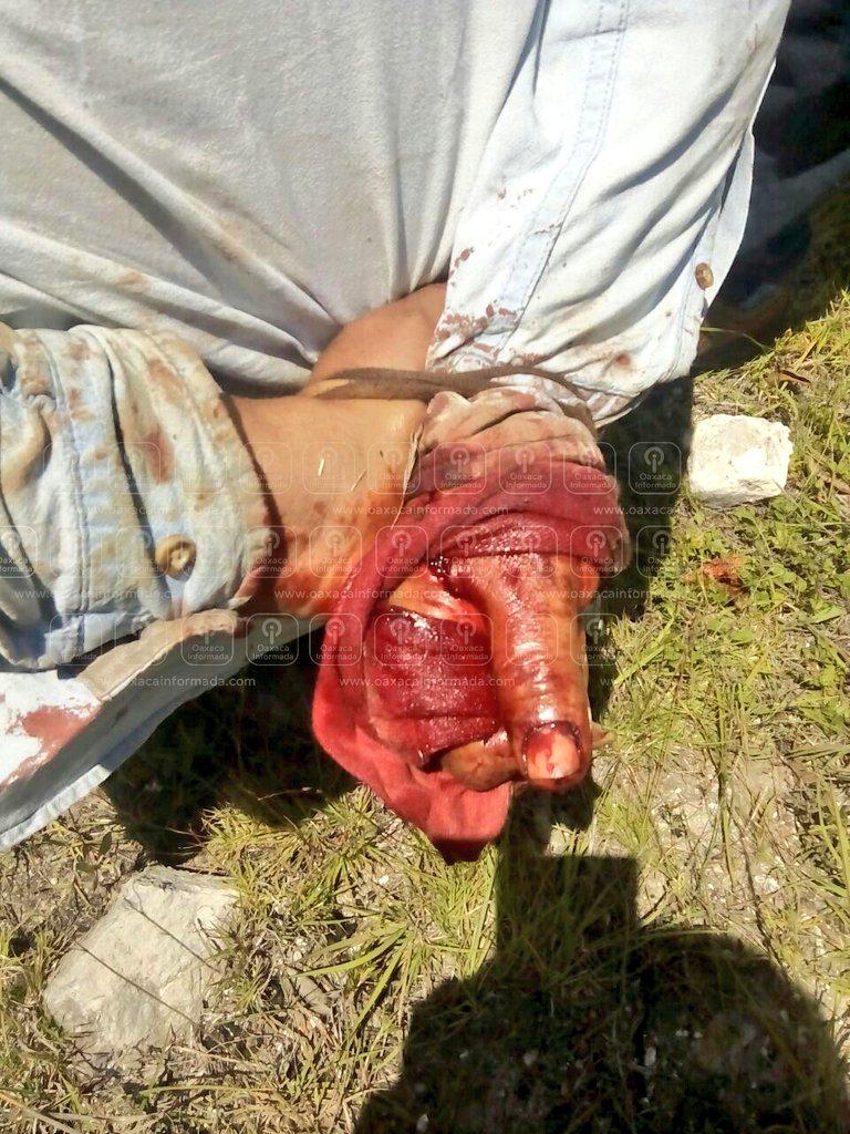 OaxacaInformada's tweet photo. @Policia_GobOax y AEI detienen a Erick Imeldo Ríos de Loxicha, presunto asesino de hombre en Punta Vizcaya #Oaxaca http://t.co/HnRKNIfBUn