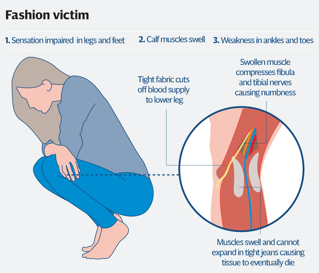 twofoldasia's tweet image. Here's why #skinnyjeans fans need to watch out. Pls RT #StyleTuesday buff.ly/1KeM1PW