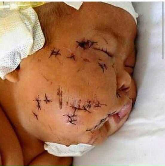 Cani yanan sabretsin , Cani yakan da yanacagi günü beklesin.
-H.z.Muhammed (s.a.v.)
#DoğuTürkistan  Rabbim yardim et