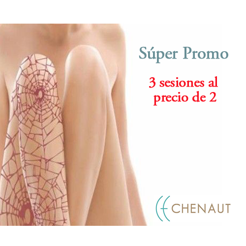 CCHENAUT's tweet photo. Volvé a lucir tus piernas con un tratamiento FÁCIL y RÁPIDO gracias a la -nueva tecnología de Spider. http://t.co/I4oNRap6YM