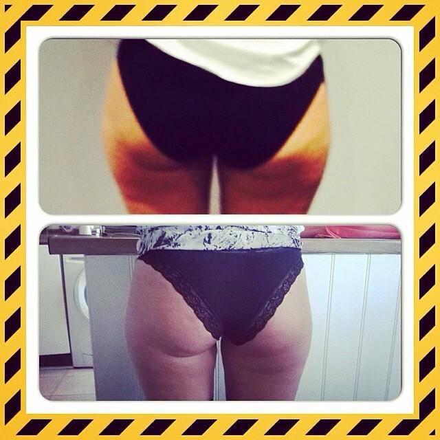 JaqMac's tweet photo. 1st Session of 3D Lipo ... And still 7 more sessions to go!!!! 
Only available @sunsetbeachuk Argyle St &amp; Springburn http://t.co/4C24wbEgRs
