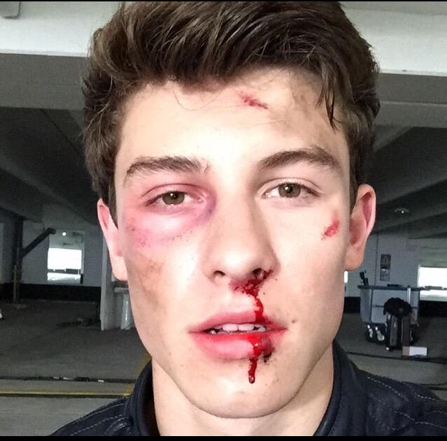Rachael_Croke's tweet photo. My Recreation of @ShawnMendes makeup from the #StitchesVideo ๐๐ผ RT? Please&Thank You๐ http://t.co/z72lEOhMVS