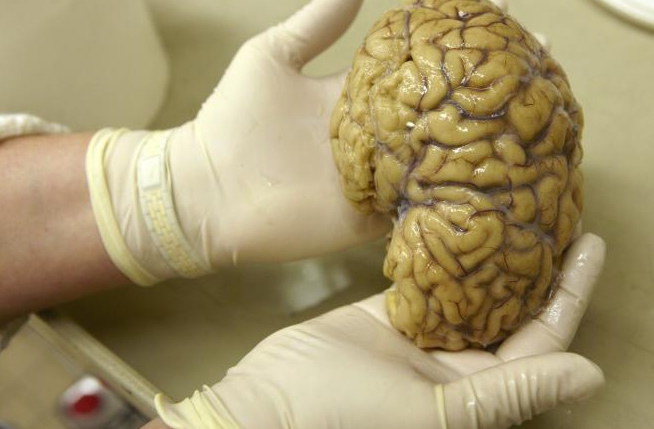 disclifechannel's tweet photo. RT @medicaldailycom: You inherit the wrinkles in your brain. http://t.co/4Rg1H6s14a http://t.co/kJTF2rR4zP