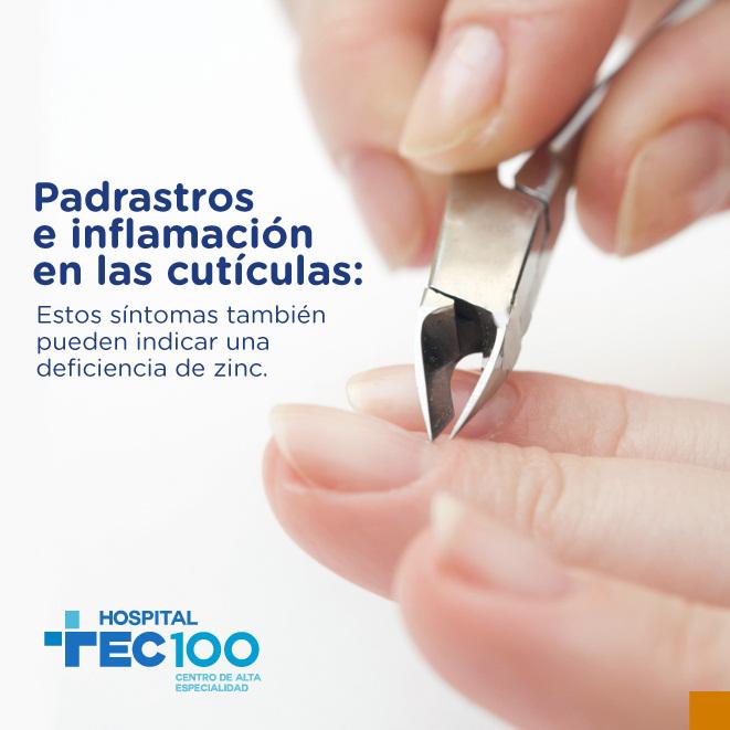 HTEC100's tweet photo. ¿Sabías que? Los padrastros puedes salir porque a tu cuerpo le hace falta Zinc.#semanadelasalud http://t.co/6U5hX3PSYh