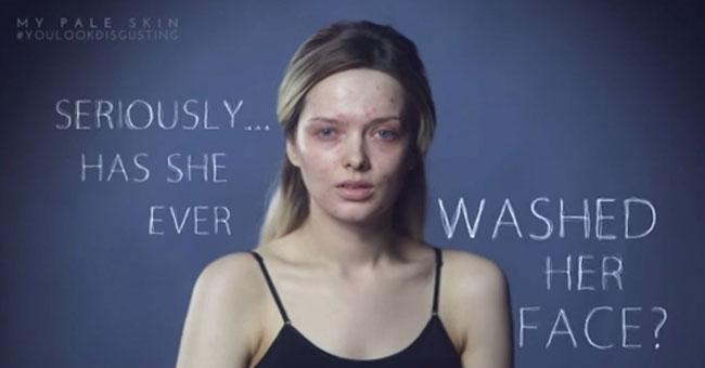Lookmagazine's tweet photo. Dare you to watch without crying. It's the viral sensation that takes down internet bullies... http://t.co/JMOBPVMDD8 http://t.co/RXSoIamQcV