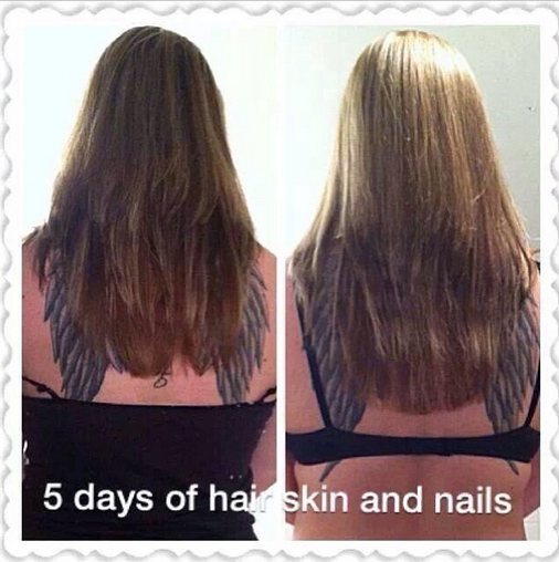 sbonilla1979's tweet photo. I love results like these!!! Who wants to grow their hair? http://t.co/RaALgz5egF