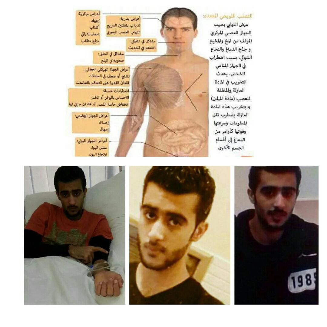 LeenkhalilLeen's tweet photo. #المعتقل_محمد_فرج
يتعرض للموت البطيئ
مصاب بمرض التصلب اللويحي
#عذابات_محمد_فرج
#البحرين http://t.co/pDwPxzl8xS