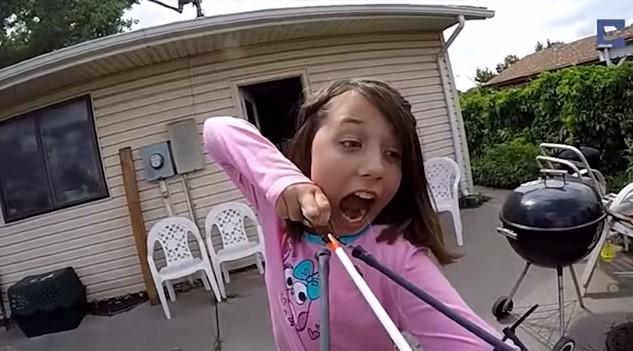 BleacherReport's tweet photo. VIDEO: 11-year-old uses sling bow to take out loose tooth, dad records in slow motion http://t.co/NQ2ebb8Kid http://t.co/5IbvhSjxpJ