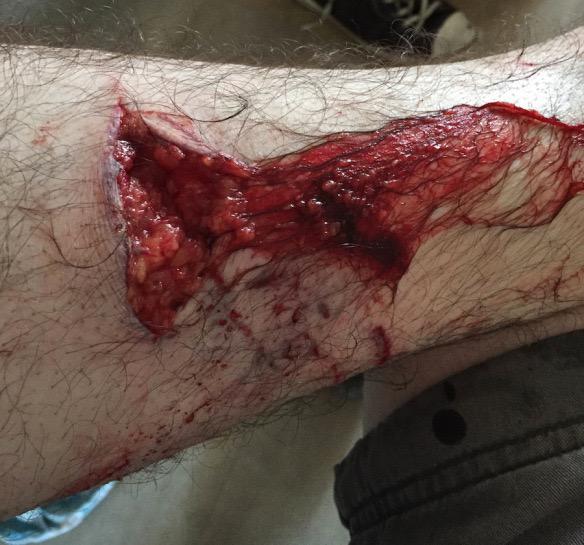 1/2 Afgelopen woensdag is een man op de postiljonheide aangevallen door een hond. Baas en hond zijn gevlucht. Tips?