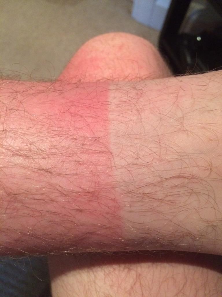 grodriguez1064's tweet photo. Im not burnt
Just very slowly turning into a tomato http://t.co/BaR5pVNsf0