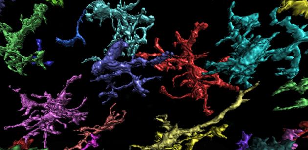 Sex divide seen in mechanism that produces persistent pain ow.ly/P94Bw