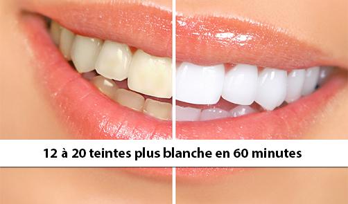 jcgagne's tweet photo. 59$ pour un traitement professionnel de blanchiment des dents au LED http://t.co/wtLBQxN6wd  #rabais http://t.co/p8VeHU6BJG