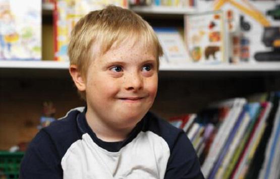 99% of People With Down Syndrome Love Their Lives, So Why Are 90% Killed in Abortion? buff.ly/1TeKI57