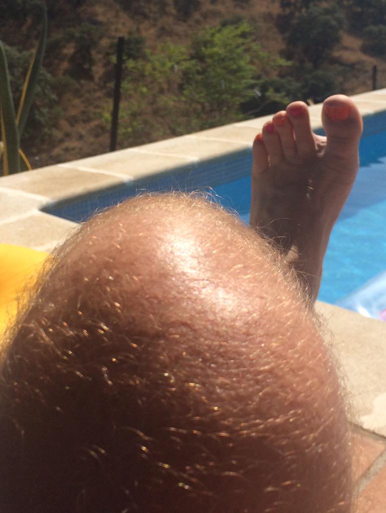 Armthorpe Welfare JFC on X: Hairy knees tweet from mysunbed wolvesfamily  my hairy knee gets ready to party mailsdone have a good week  http:t.coiZzUXL2bkV  X