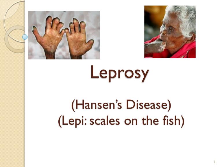 Useful slideshow outlining the pathophysiology of Leprosy meducation.net/resources/1164… #meded