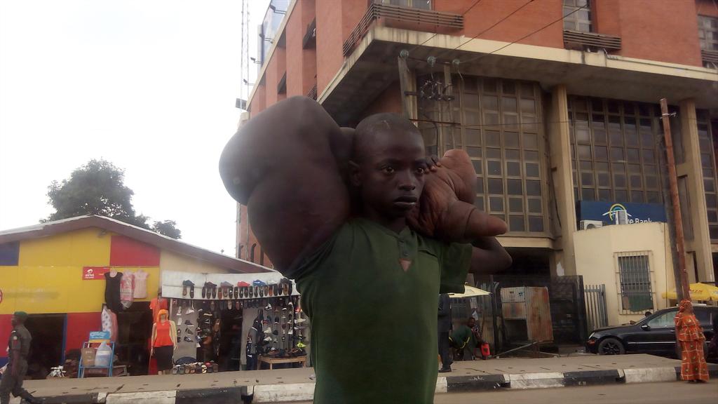 Photos: Boy with enlarged arm begging for help in Ikeja, lagos
