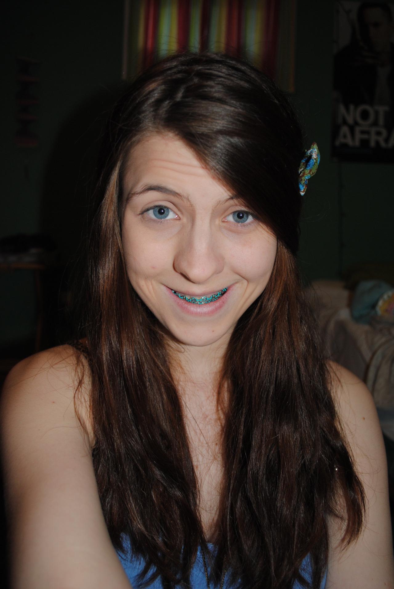 Girls With Braces on Twitter "Cute Blue braces http//t.co/Le9i35kYs9