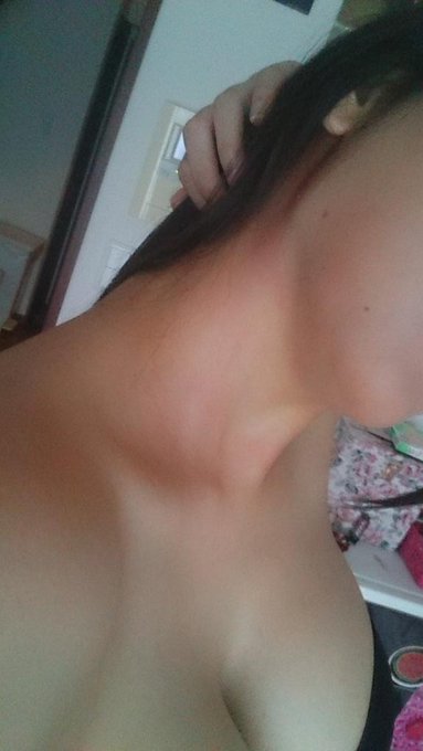 いきなり真っ赤になって痒い(&acute;&times;&omega;&times;`) http://t.co/4siPse92MR