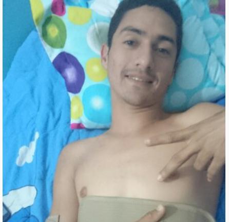 todo bien!!! Reposo unas cuantas  semanas...recuperate mejor de america.....<a href="/1982danielr/">Daniel Reyes</a> <a href="/HipicoNestor/">Nestor reyes</a>