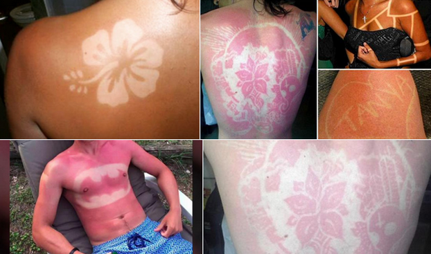 KDKA's tweet photo. Ouch! Experts warn that new social media trend of #SunburnArt could be really dangerous. http://t.co/qHRh2GI7Vg http://t.co/nTiNWp9tAa