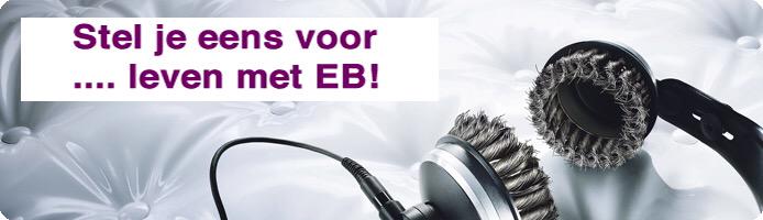 maxgulickx's tweet photo. Stel je eens voor ... Leven met EB
http://t.co/eeFK4opWPn http://t.co/lhITF5L0Jq