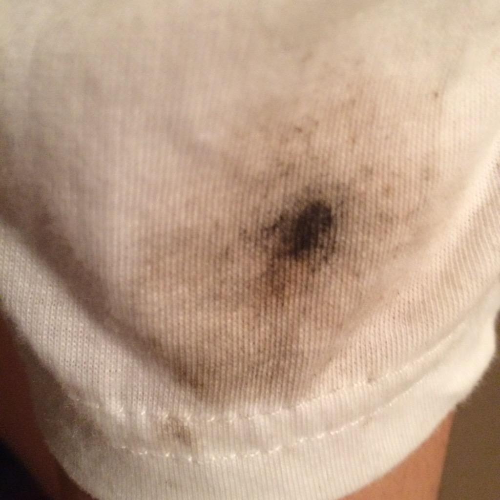 sk0920921's tweet photo. 花火服に当たったしな
ススだらけやわ http://t.co/6sMvUppUzW