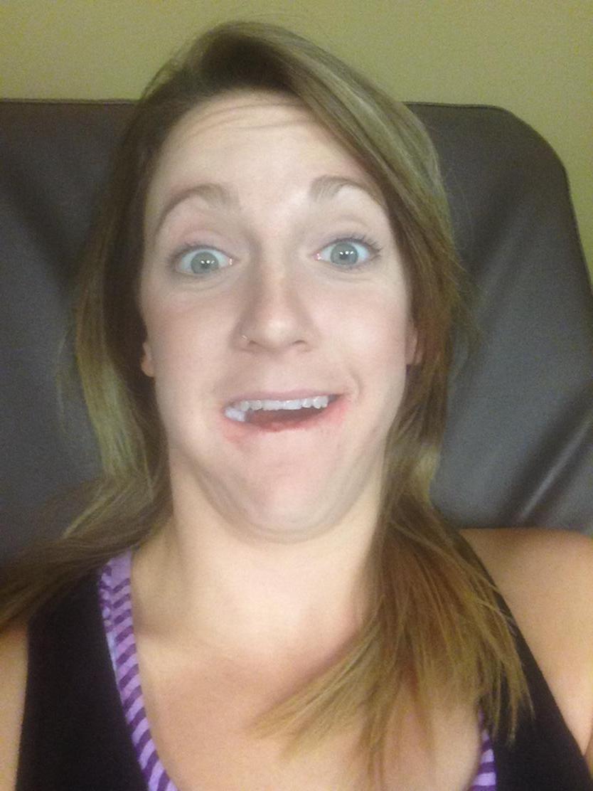 rosecutrer44's tweet photo. Out of surgery and feel like a balloon. http://t.co/pBQ6UqA6kS
