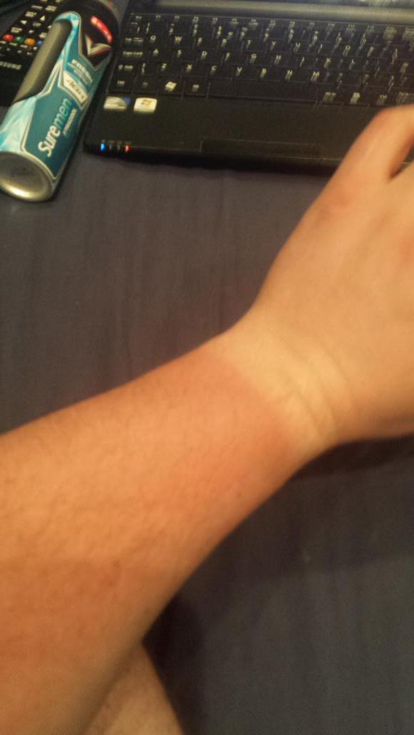 dowdall7's tweet photo. Got a better tan in one day in manchester then 3 weeks in cambodia!!!! http://t.co/EIF0uD2qhs