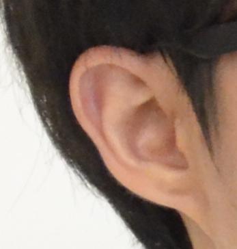 美好くん どうも 妖怪耳たぶなし男です Http T Co 3s0pyddh7l