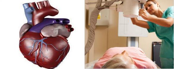 Medindia's tweet image. #Rotablator and #3D Mapping For #Cardiac Cases To Be Inaugurated In #Mangaluru, #India
bit.ly/1NTAeEE