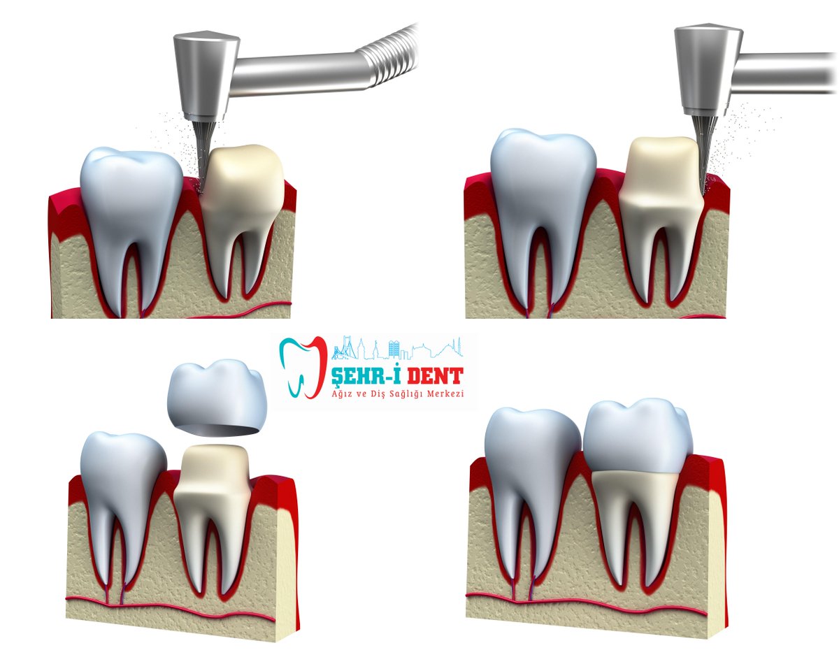 7/24 açık diş hastanesi #gülüşünüzesağlık