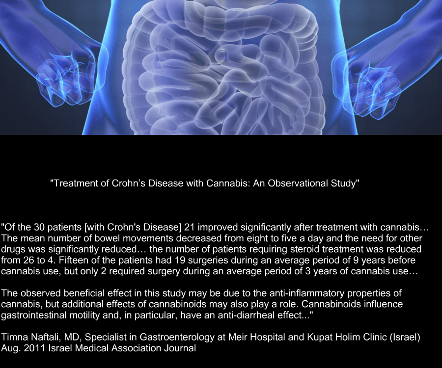 MME_MEMPHIS's tweet image. Cannabis and Crohns

#cannabis #crohns #marijuana #ibs #medicalmarijuana #heath #thc #cbd #hempoil