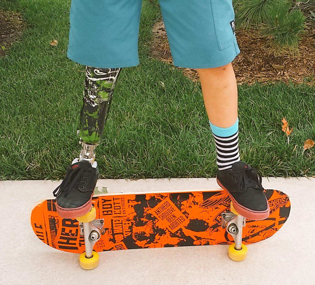 imDYLANMJONES's tweet photo. Practicing so much #olddeck broke #checkout my #newdeck @WELLDONE_SS  #skateboarding #bka @rushfoot @VANS_66 #summer http://t.co/twyVAwbIhR