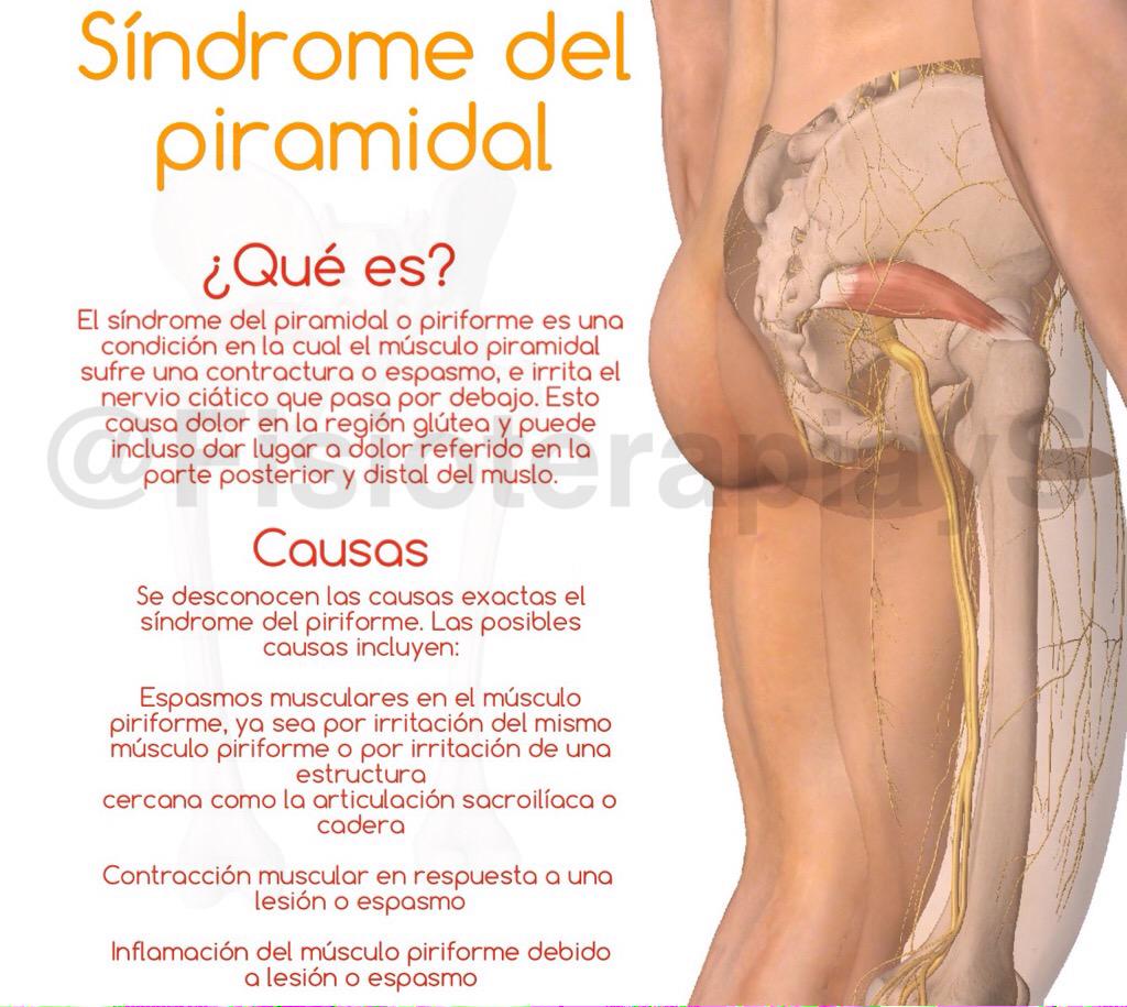 FisioterapiayS's tweet photo. ¿Sabes qué es el Síndrome del piramidal? http://t.co/Cjp9IjolsA