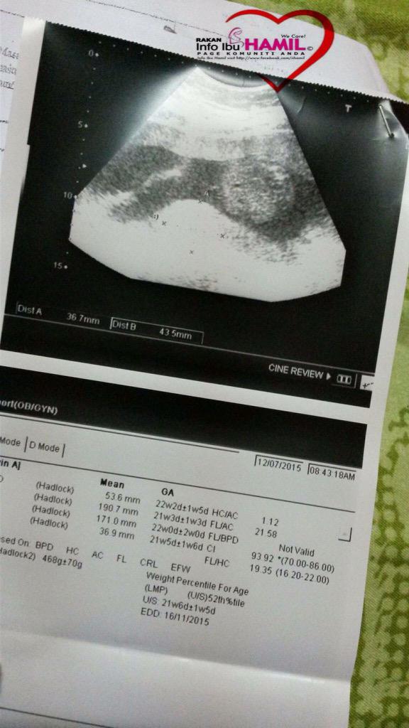 IIHamil's tweet photo. Mana 1 brt bby ek? http://t.co/E1MSial2Fz