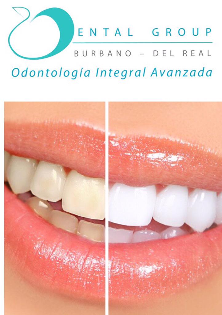 DENTALGROUPbd's tweet photo. BLANQUEAMIENTO DENTAL
Solicita tu Cita: 612 15 08 Calle 119 # 7-14 Consultorio 707 Edificio Santa Ana Medical Center http://t.co/Tr4KWeGqAJ